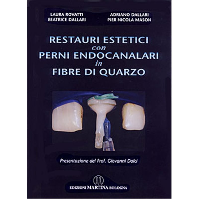 Restauri estetici con perni endocanalari in fibre di quarzo